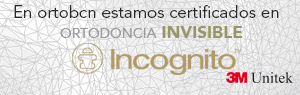 Ortodoncia Lingual
